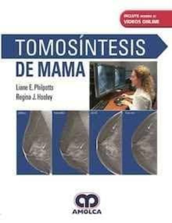 Tomosintesis De Mama + Videos Online