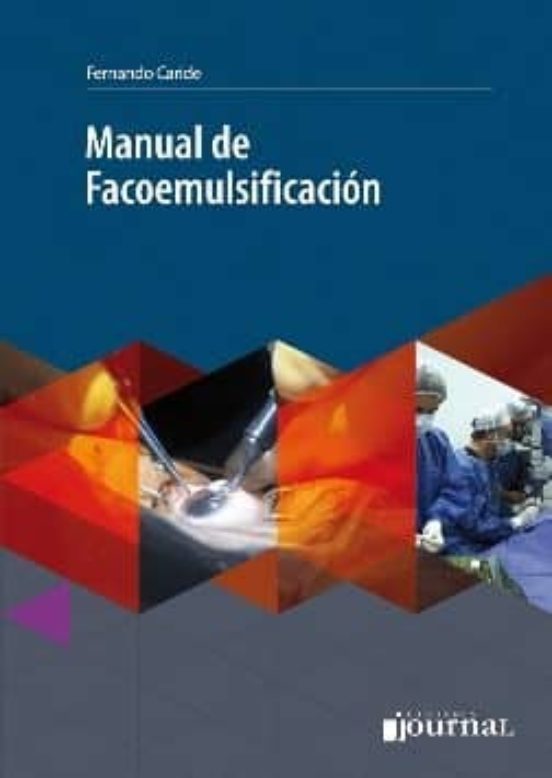 Manual De Facoemulsificacion