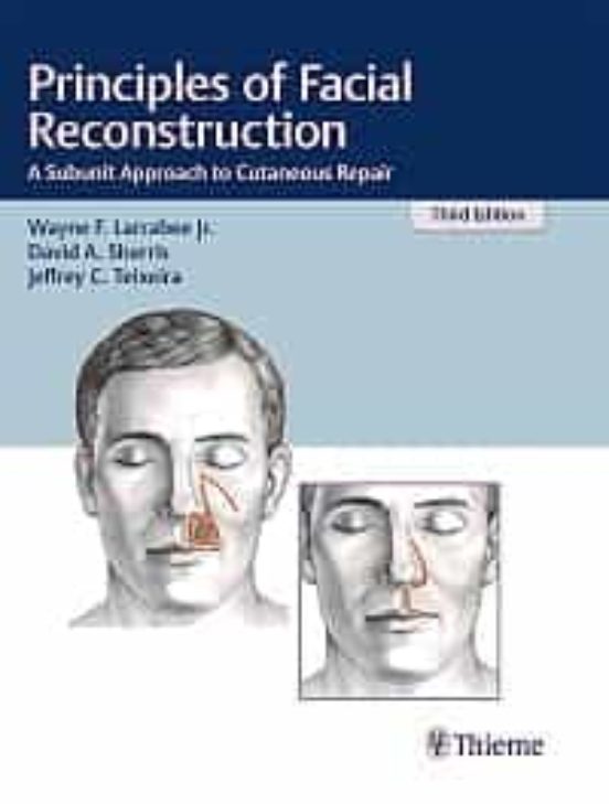 Principles Of Facial Reconstruction: A Subunit Approach To Cutane Ous