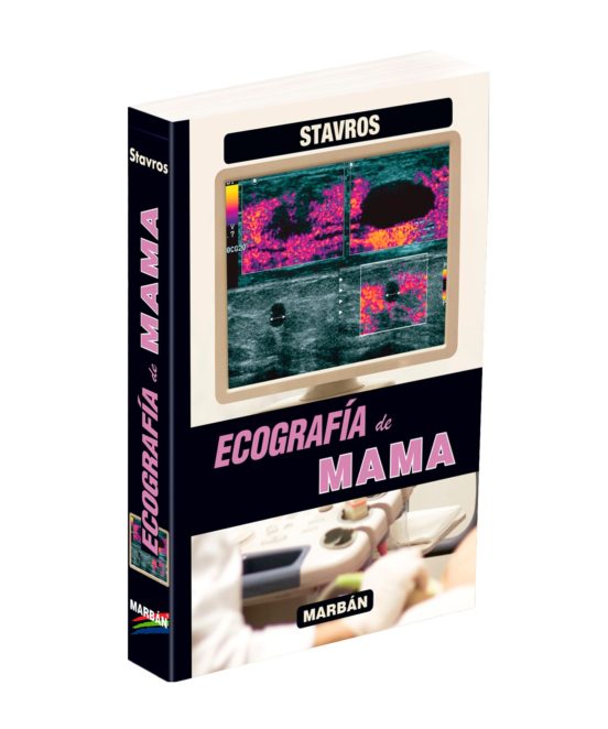 Ecografia De Mama - Stavros