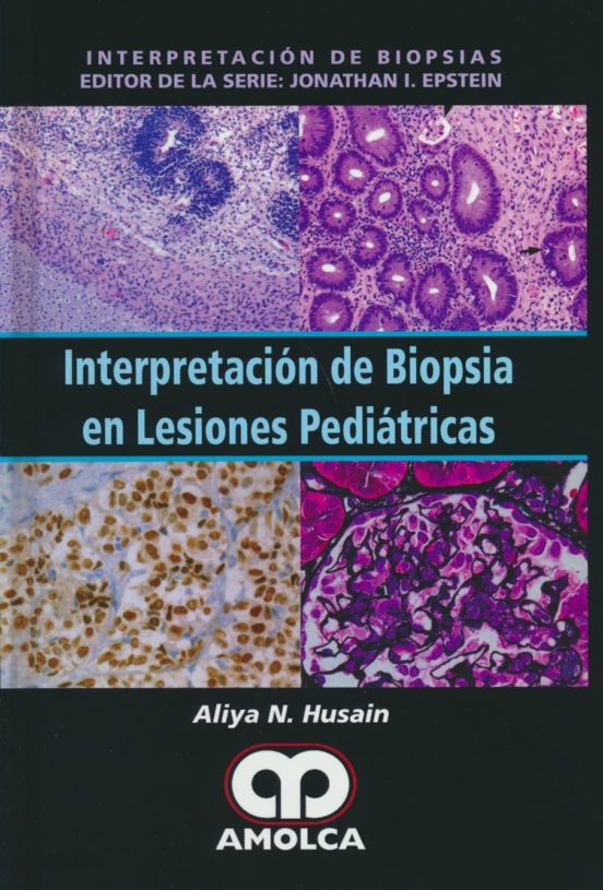 Interpretacion De Biopsia En Lesiones Pediatricas