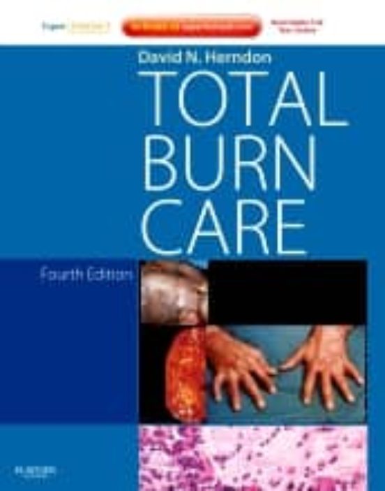 Total Burn Care