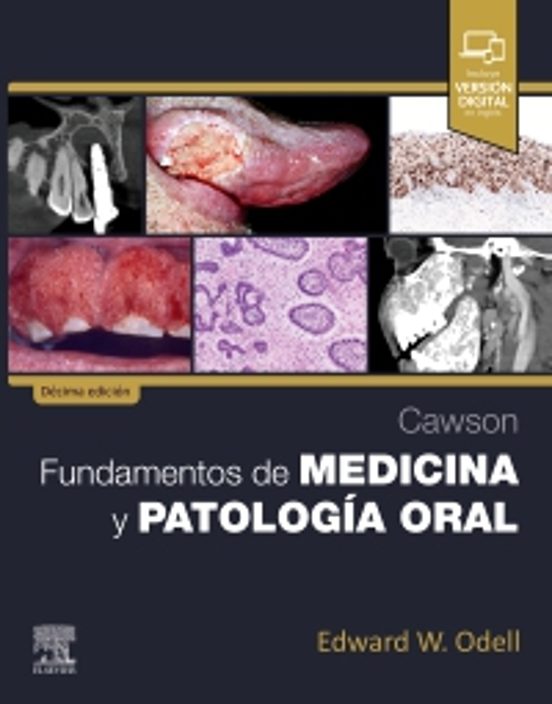 Cawson. Fundamentos De Medicina Y Patología Oral