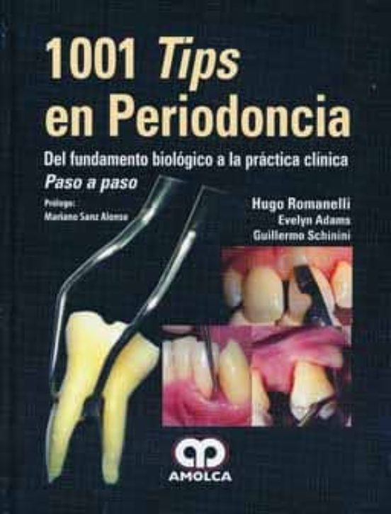 1001 Tips En Periodoncia: Del Fundamento Biologico A La Practica Clini