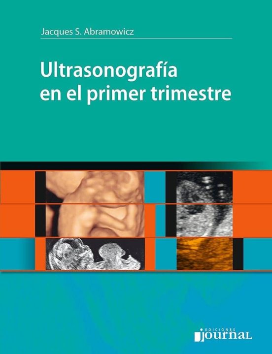 Ultrasonografia En El Primer Trimestre