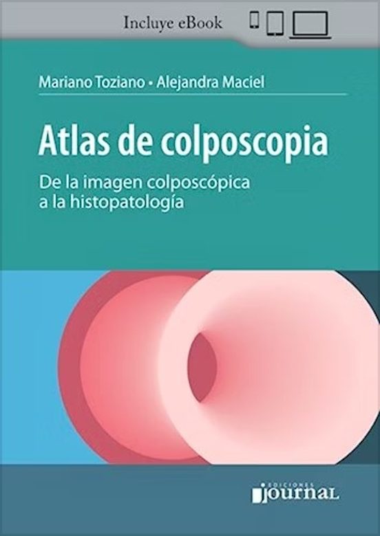 Atlas De Colposcopia. De La Imagen Colposcópica A La Histopatología
