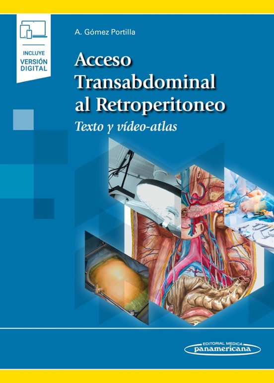 Acceso Transabdominal Al Retroperitoneo. Texto Y Video-atlas