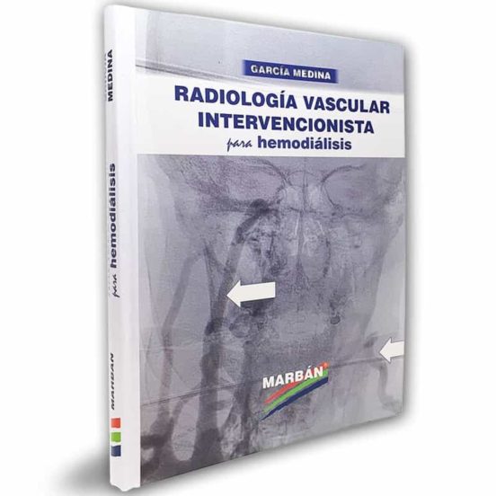 Radiologia Vascular Intervencionista Para Hemodialisis