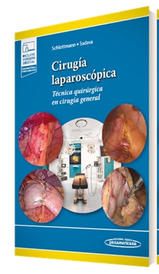 Cirugía Laparoscópica