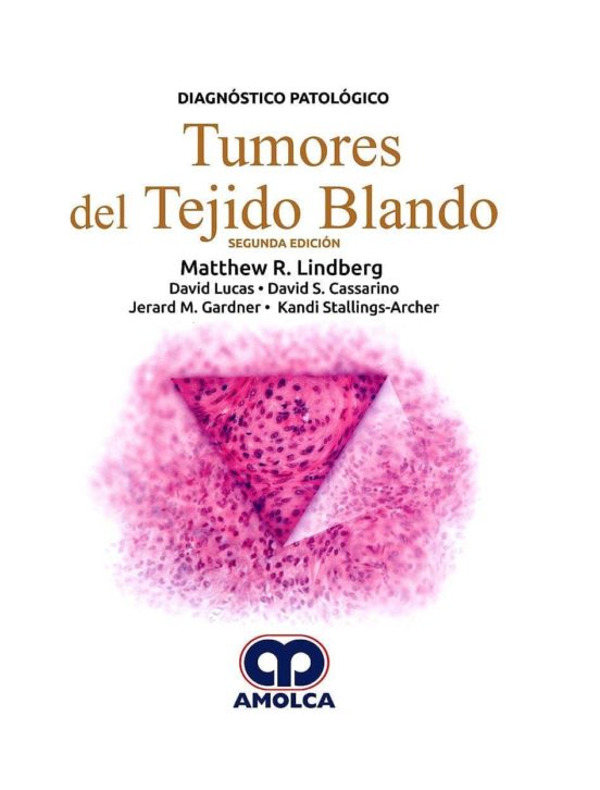 Diagnostico Patologico: Tumores Del Tejido Blando
