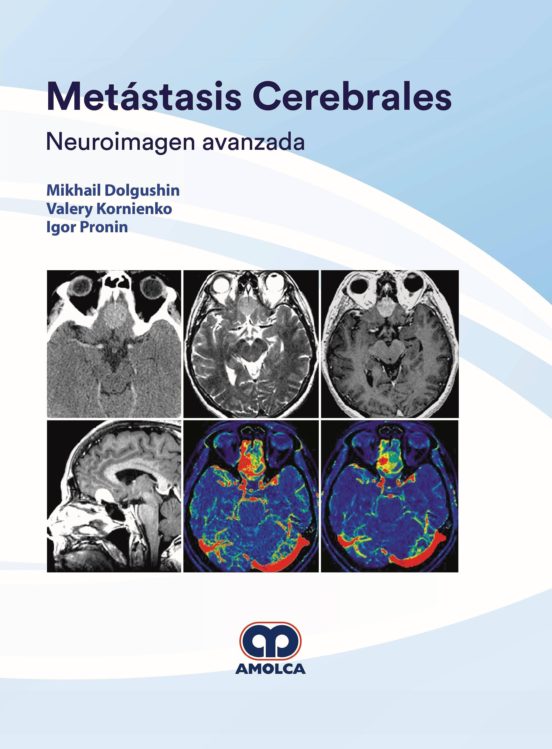 Metástasis Cerebrales. Neuroimagen Avanzada