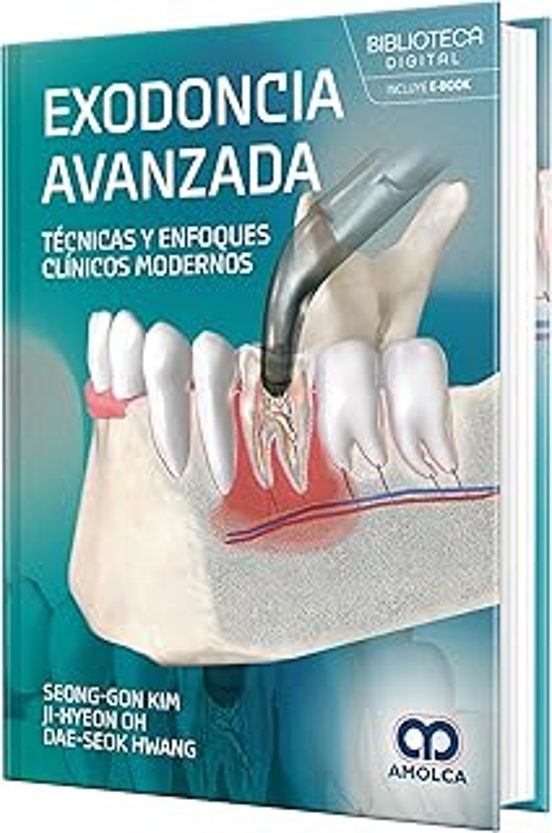 Exodoncia Avanzada