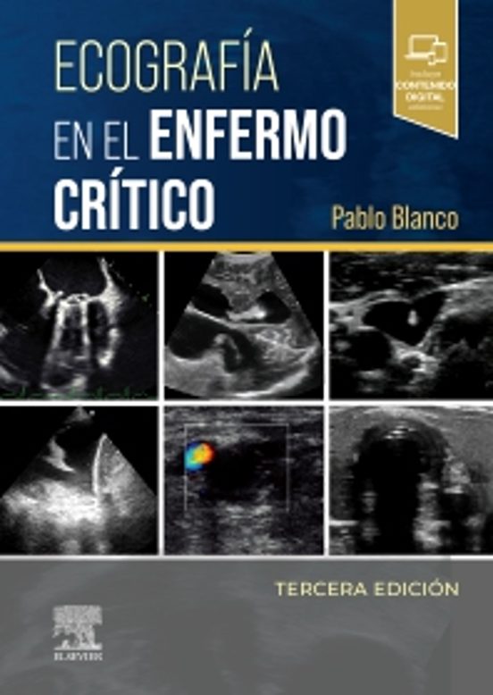 Ecografía En El Enfermo Crítico