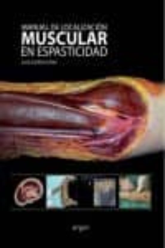 Localizacion Muscular En Espasticidad