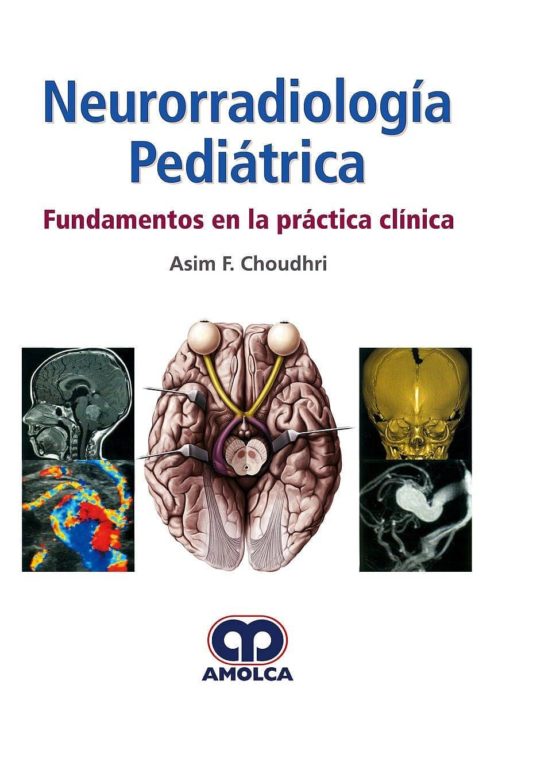 Neurorradiologia Pediatrica Fundamentos En La Practica Clinica