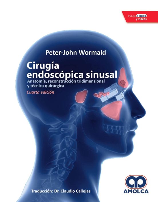 Cirugia Endoscopica Sinusal: Anatomia Reconstruccion Tridimensional Y