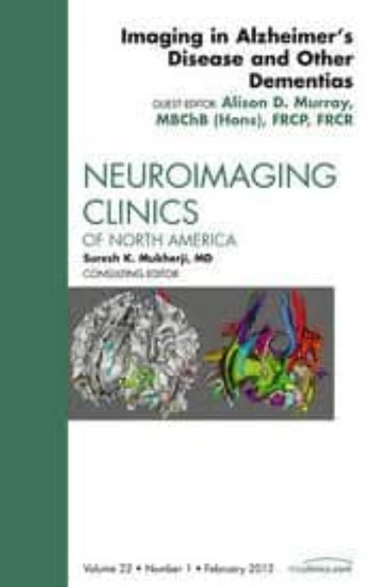 Imaging In Alzheimer S Disease And Other Dementias An Issue Of N Euroi