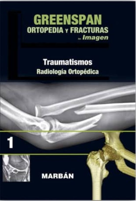 Greenspan: Ortopedia Y Fracturas Tomo I: Premium: Traumatismos: Radiol