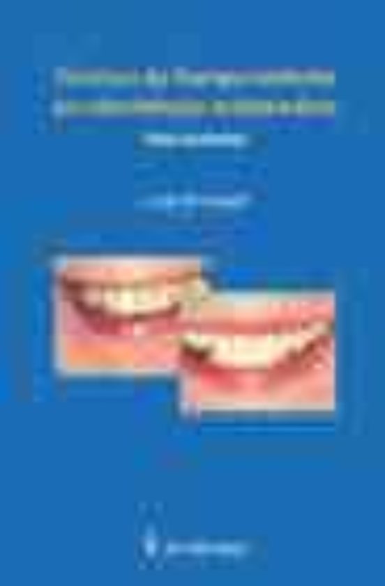 Tecnicas De Blanqueamiento En Odontologia Restauradora
