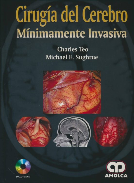 Cirugia Del Cerebro Minimamente Invasiva + Dvd
