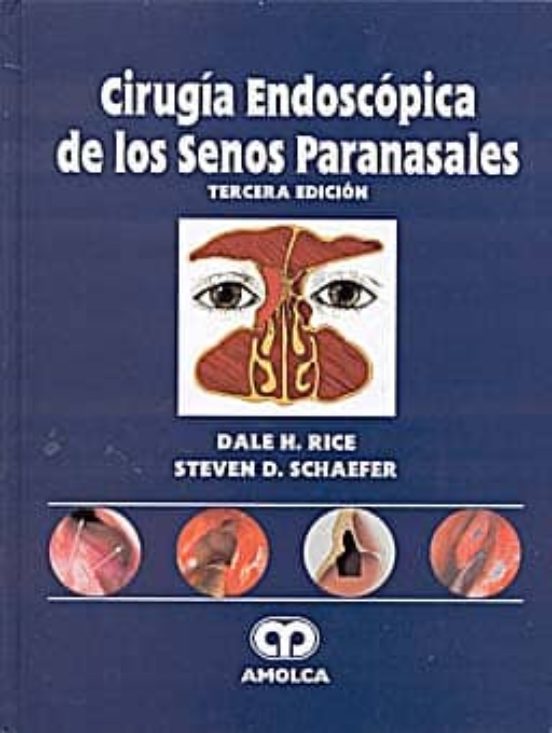 Cirugia Endoscopica De Los Senos Paranasales
