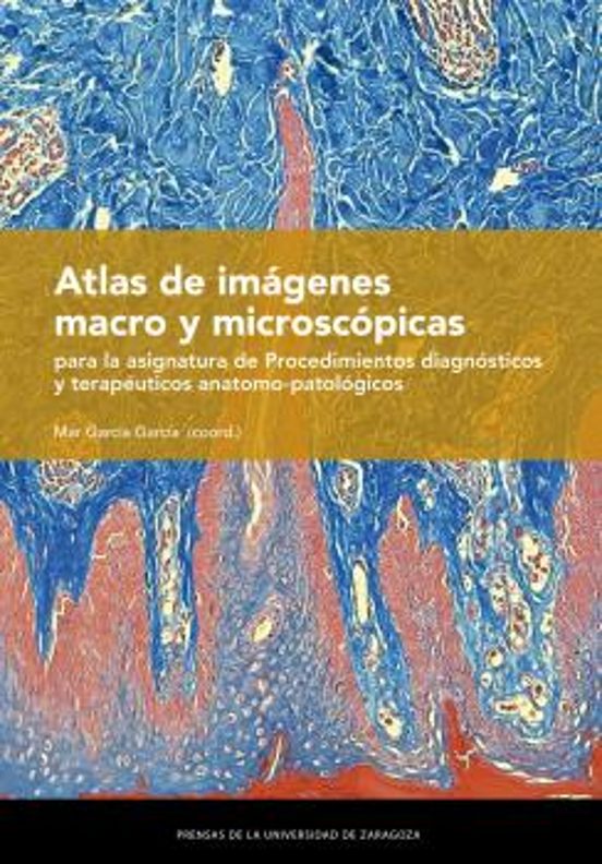 Atlas De Imágenes Macro Y Microscópicas Para La Asignatura De Procedimientos Diagnósticos Y Terapéuticos Anatomo-patológicos
