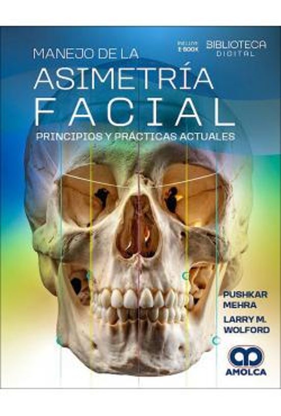Manejo De La Asimetría Facial Principios Y Prácticas Actuales