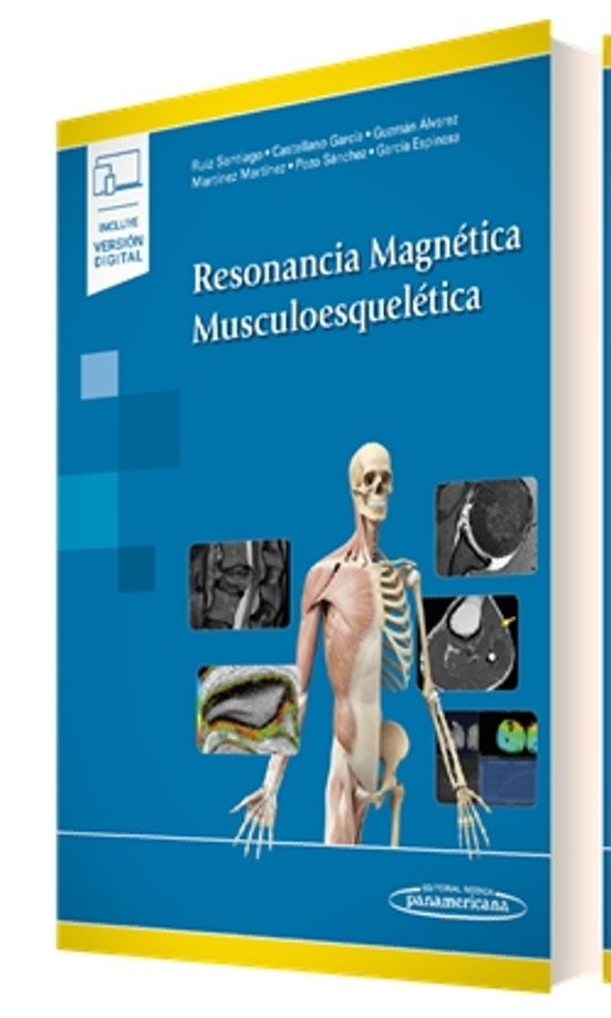 Resonancia Magnética Musculoesquelética