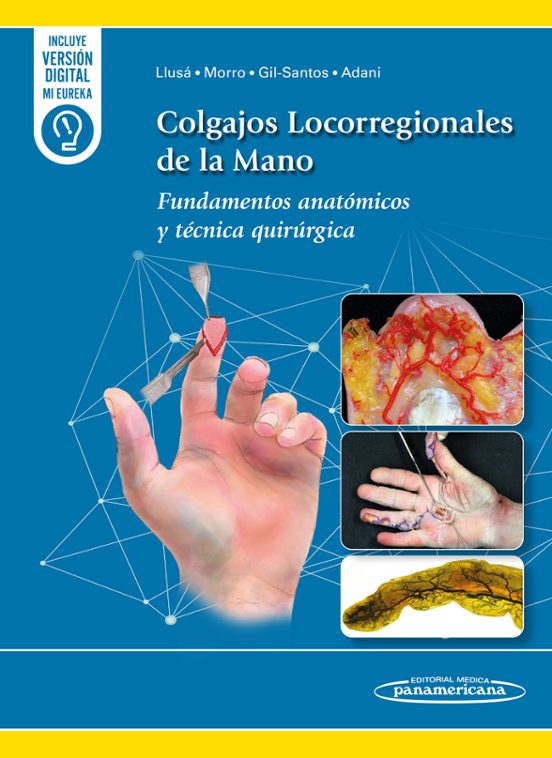 Colgajos Locorregionales De La Mano Fundamentos Anatómicos Y Técnica Q