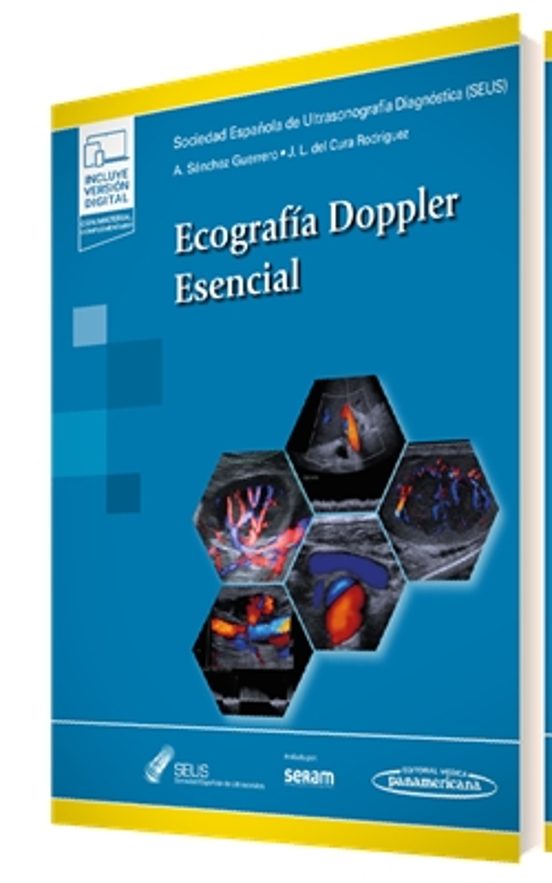 Ecografía Doppler Esencial