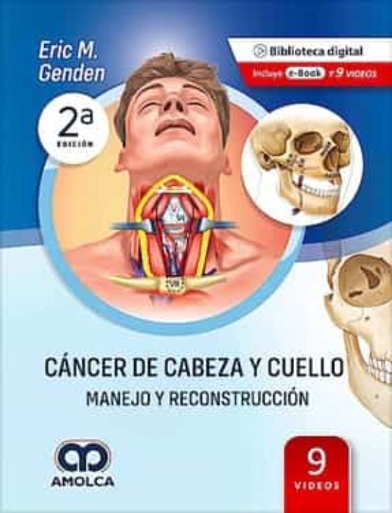 Cancer De Cabeza Y Cuello. Manejo Y Reconstruccion