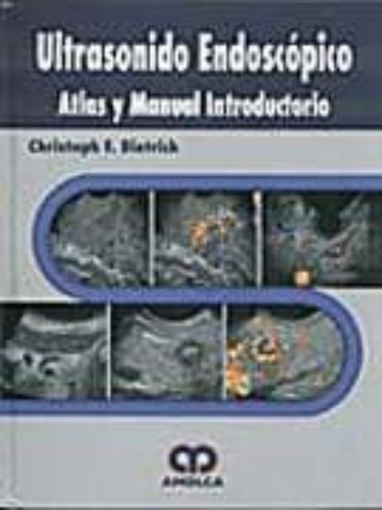 Ultrasonido Endoscopico. Atlas Y Manual Introductorio