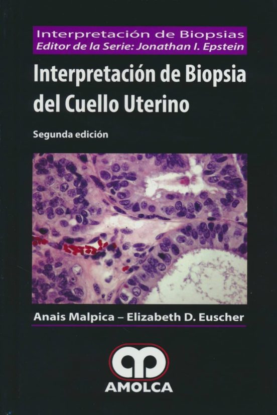 Interpretacion De Biopsia Del Cuello Uterino
