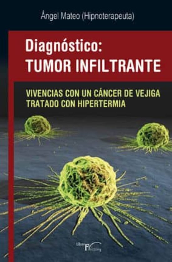 Diagnostico Tumor Infiltrante: Vivencias Con Un Cancer De Vejiga Trata
