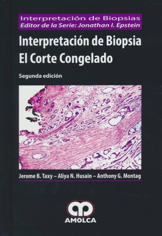 Interpretacion De Biopsia. El Corte Congelado