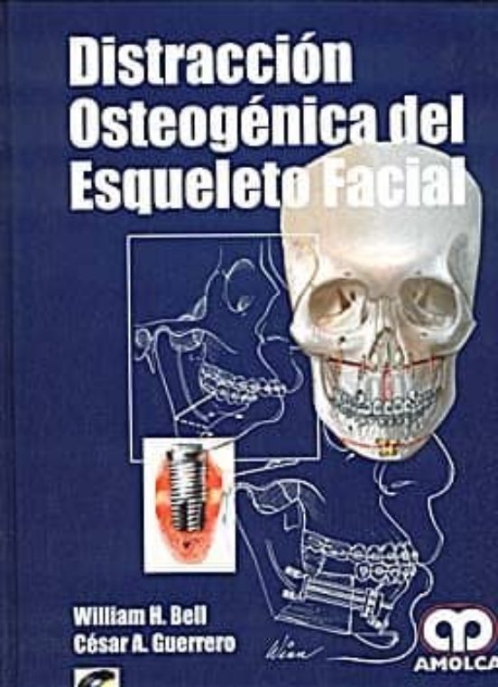 Distraccion Osteogenica Del Esqueleto Facial + Cd-rom