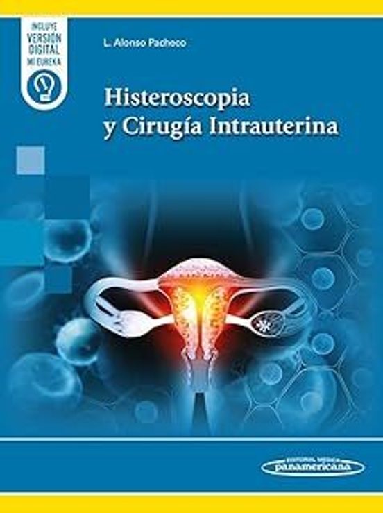Histeroscopia Y Cirugía Intrauterina