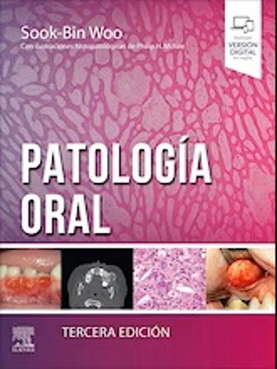 Patología Oral