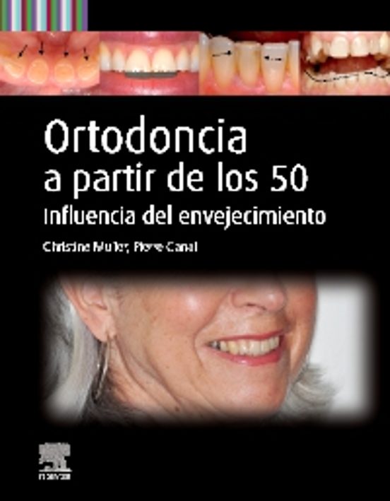 Ortodoncia A Partir De Los 50