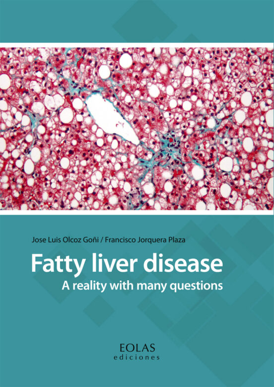 Fatty Liver Disease