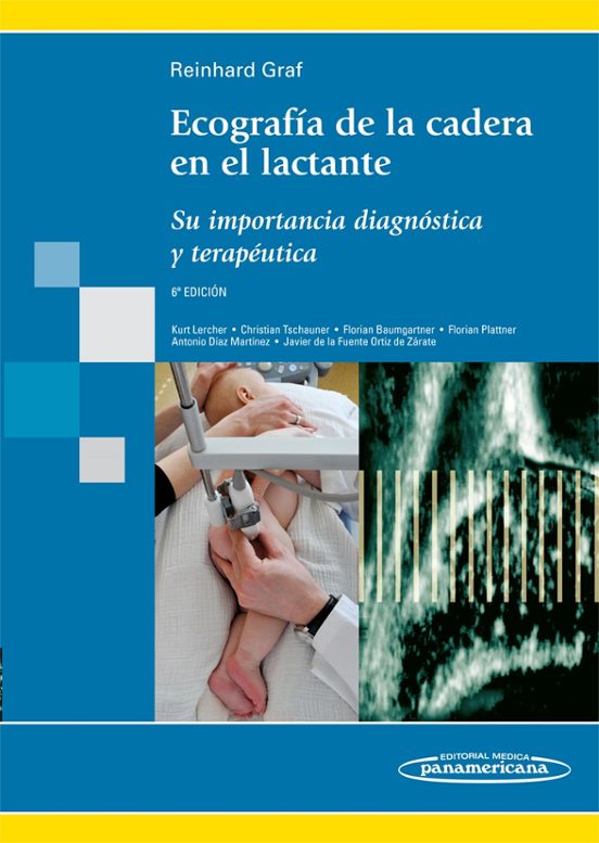 Ecografia De La Cadera En El Lactante