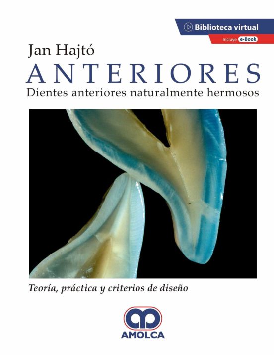 Anteriores. Dientes Naturalmente Hermosos. Teoría Práctica Y Criterios