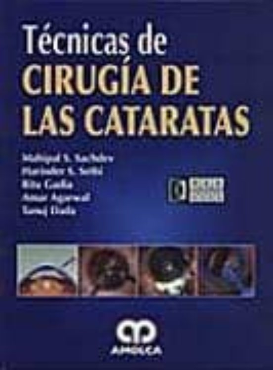 Tecnicas De Cirugia De Las Cataratas
