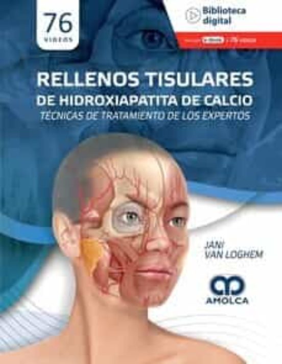 Rellenos Tisulares De Hidroxiapatita De Calcio. Técnicas De Tratamient