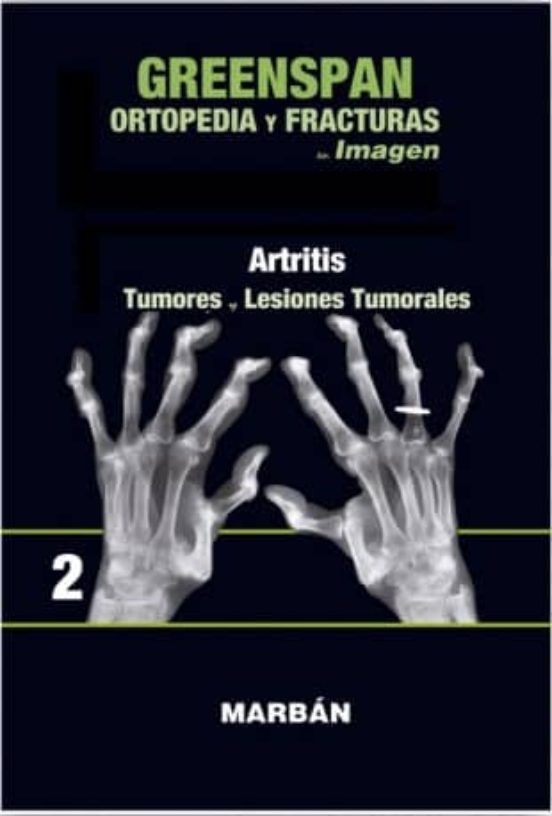 Greenspan: Ortopedia Y Fracturas Tomo Ii: Premium: Artritis: Tumores L