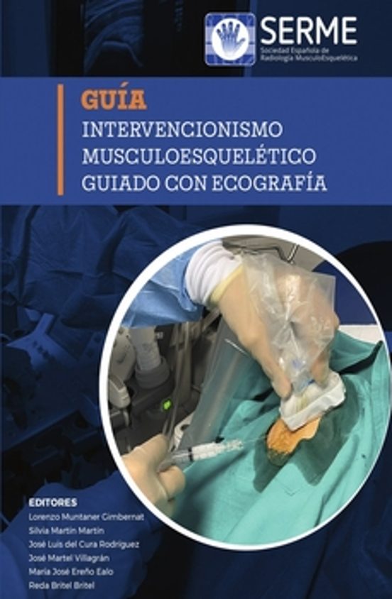 Guía Intervencionismo Musculoesquelético Guiado Con Ecografía