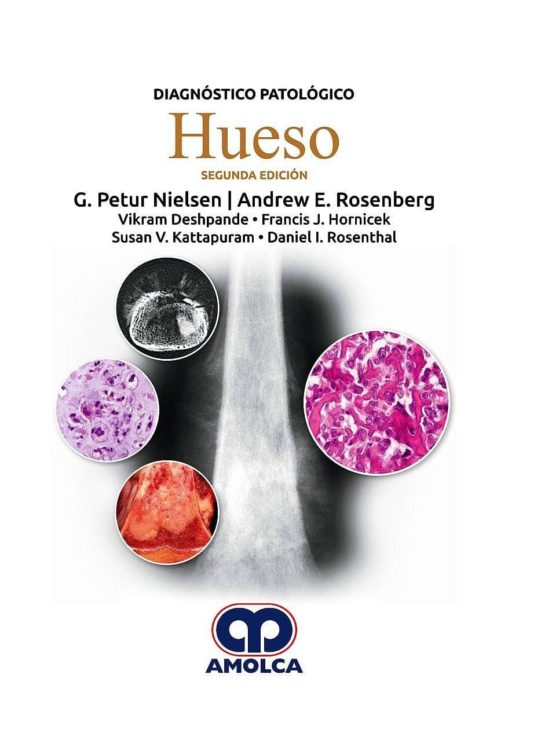 Diagnostico Patologico: Hueso