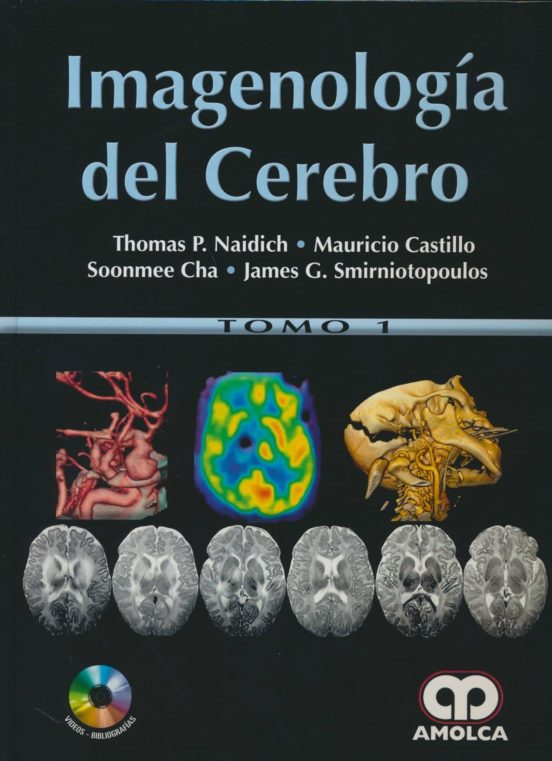 Imagenologia Del Cerebro