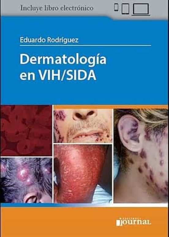 Dermatologia En Vih/sida