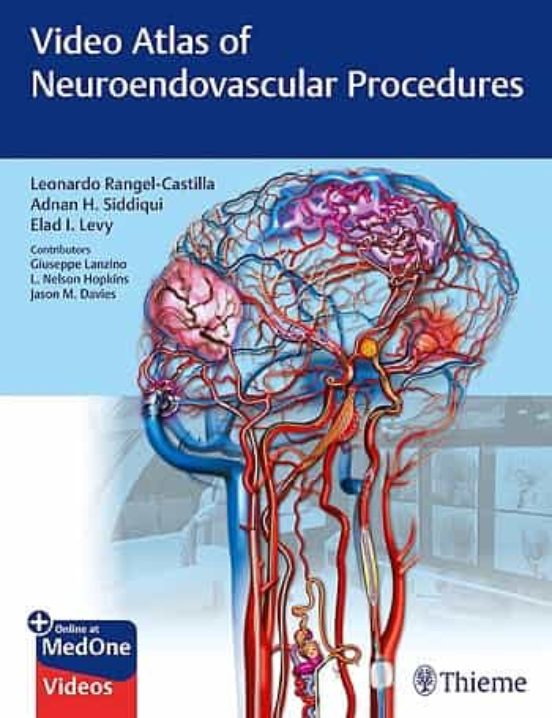 Video Atlas Of Neuroendovascular Procedures